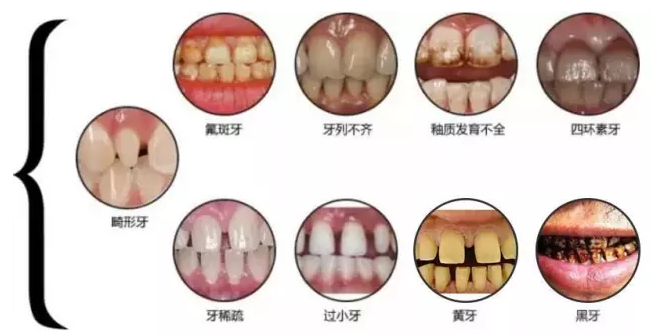 怎么快速让自己的嗓子变好 4744_170120105613_1.png