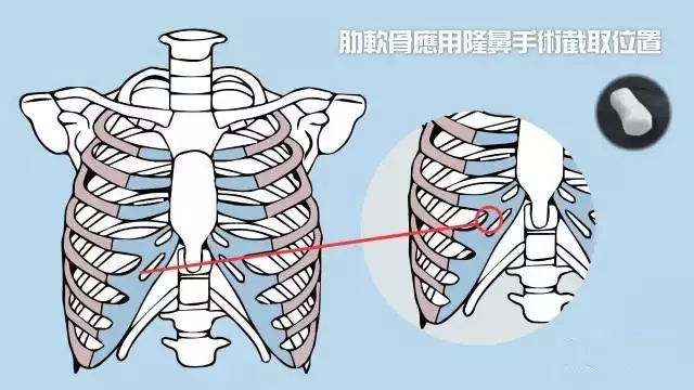4744_170510103427_1.jpg