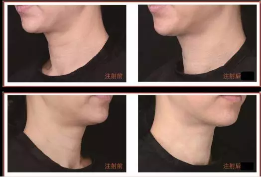 4744_170801155321_1.png